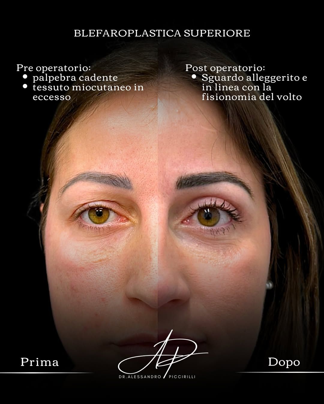 Sguardo rigenerato e naturalezza dei lineamenti