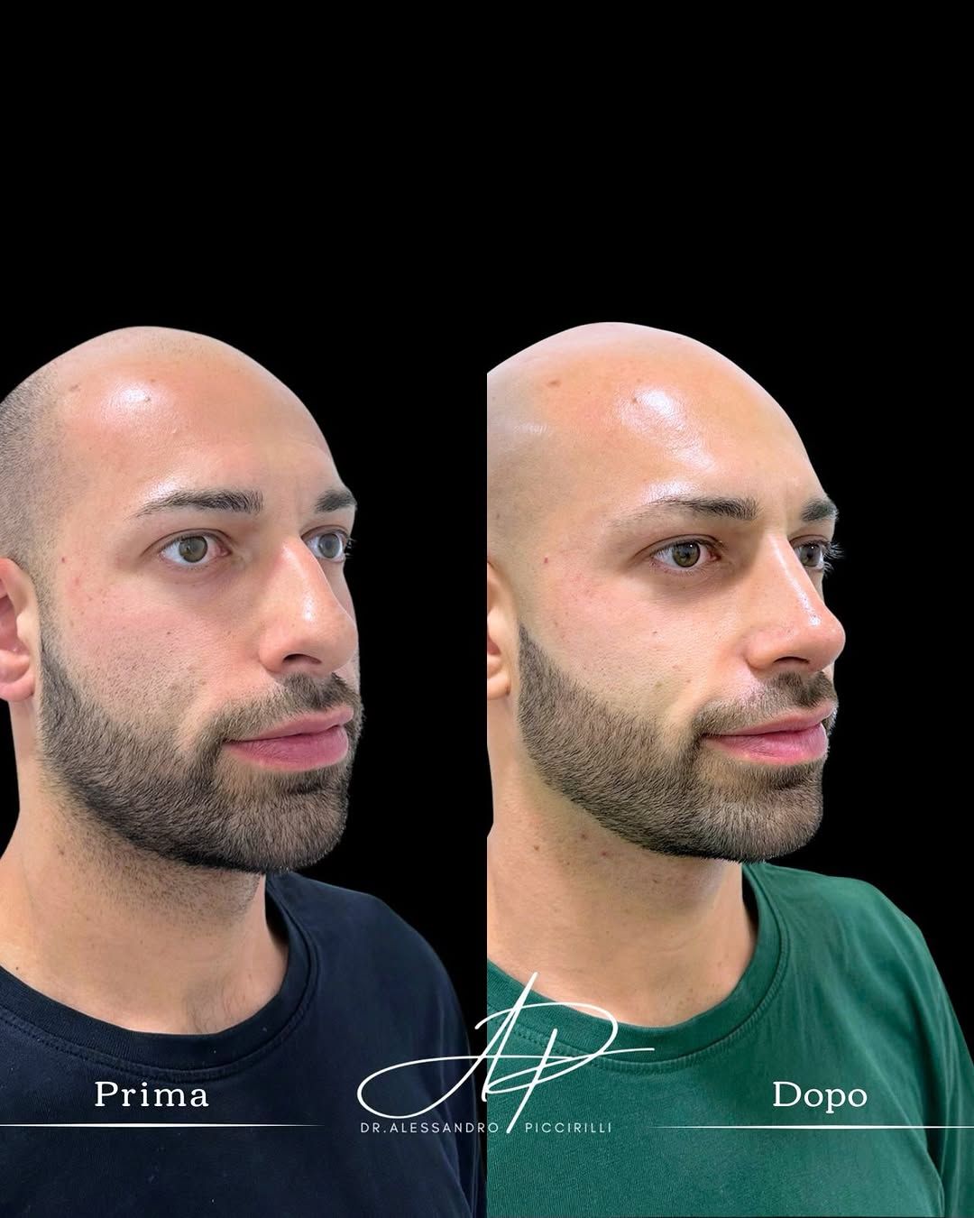 Armonia e naturalezza del profilo maschile