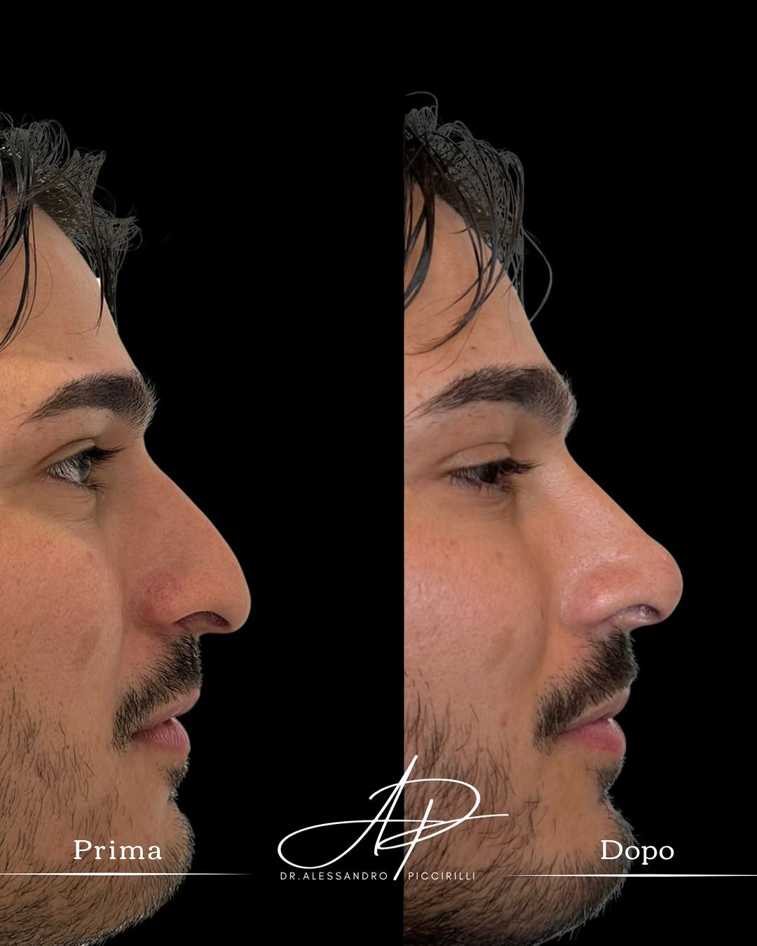 Armonia e naturalezza del profilo maschile