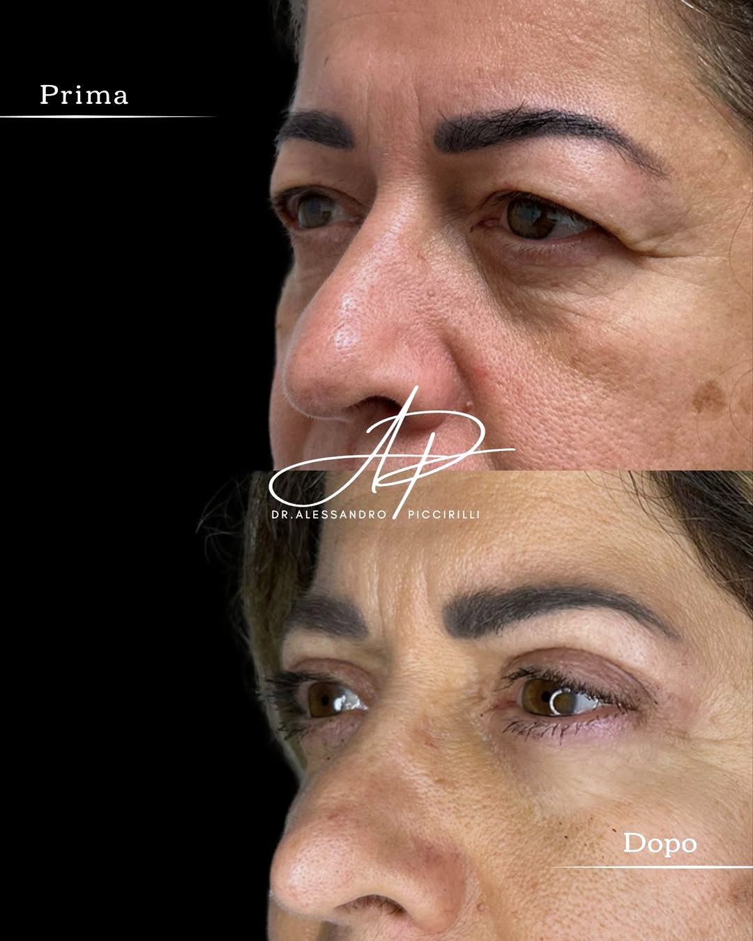 Sguardo rigenerato e freschezza naturale nei dettagli