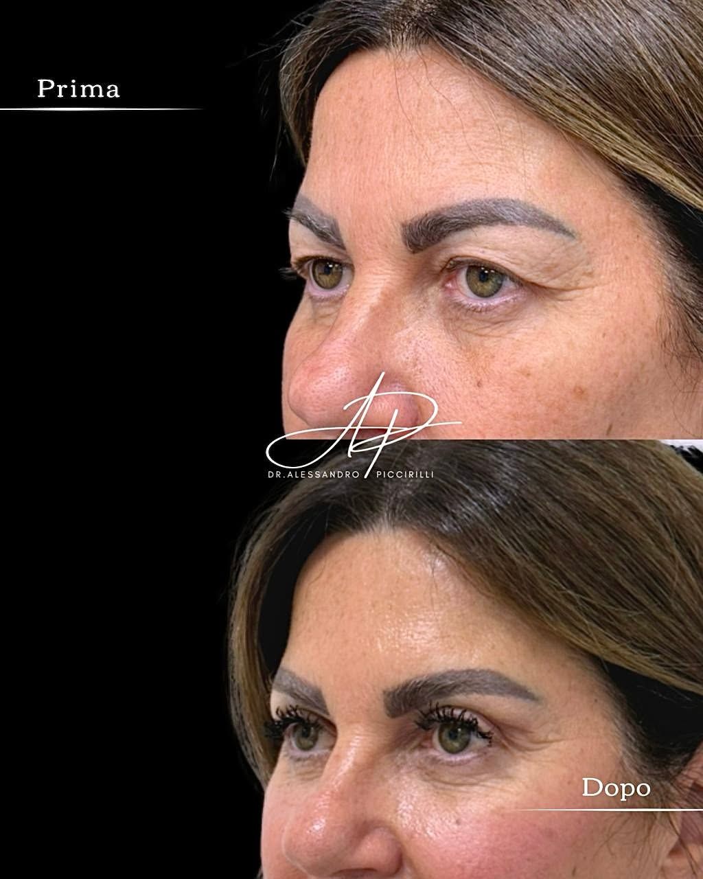 Sguardo rigenerato e naturalezza espressiva