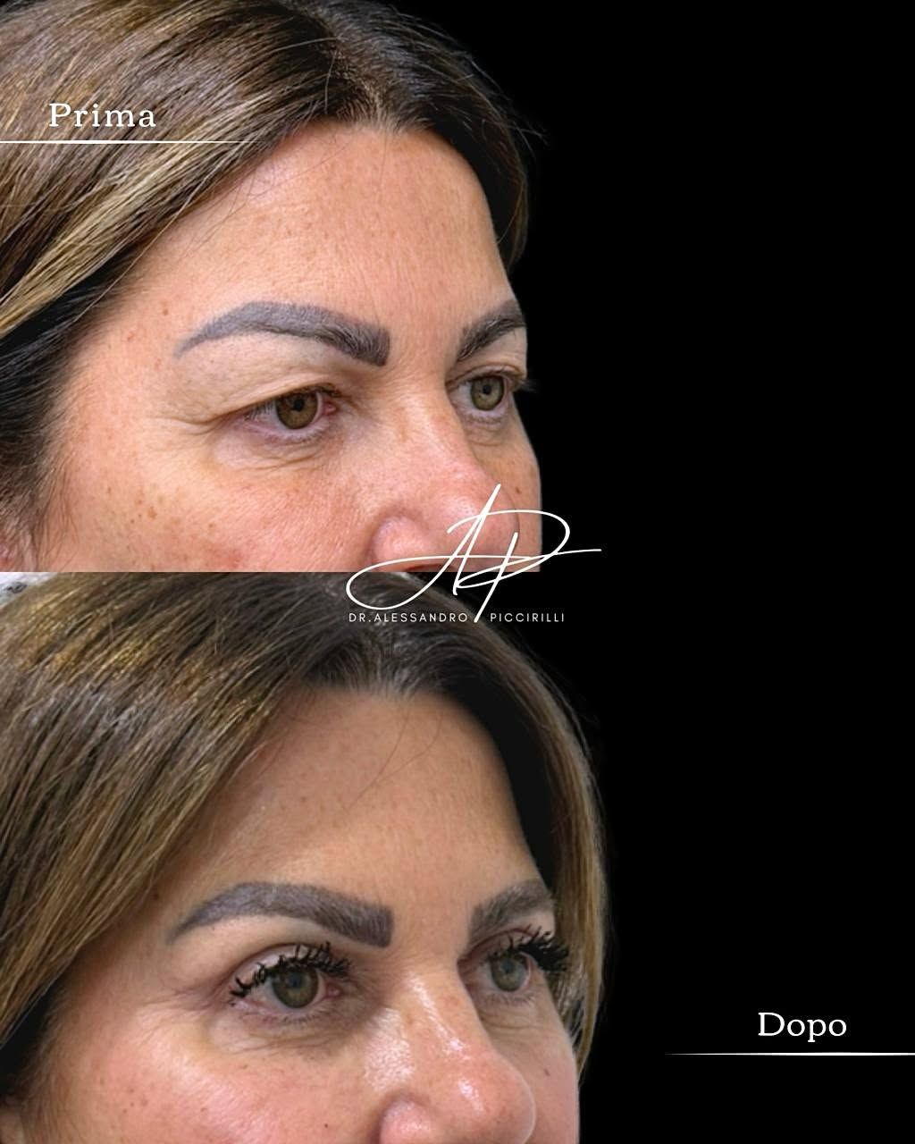 Sguardo rigenerato e naturalezza nei dettagli