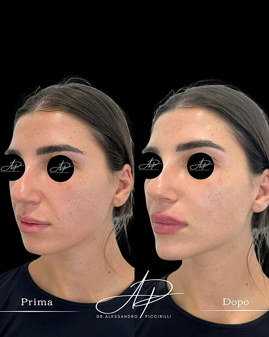 Armonia e naturalezza nel profilo del volto