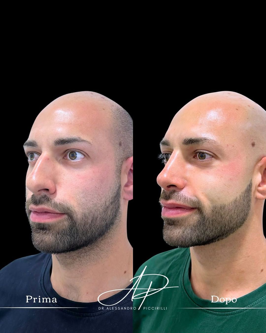 Armonia e naturalezza nel profilo maschile