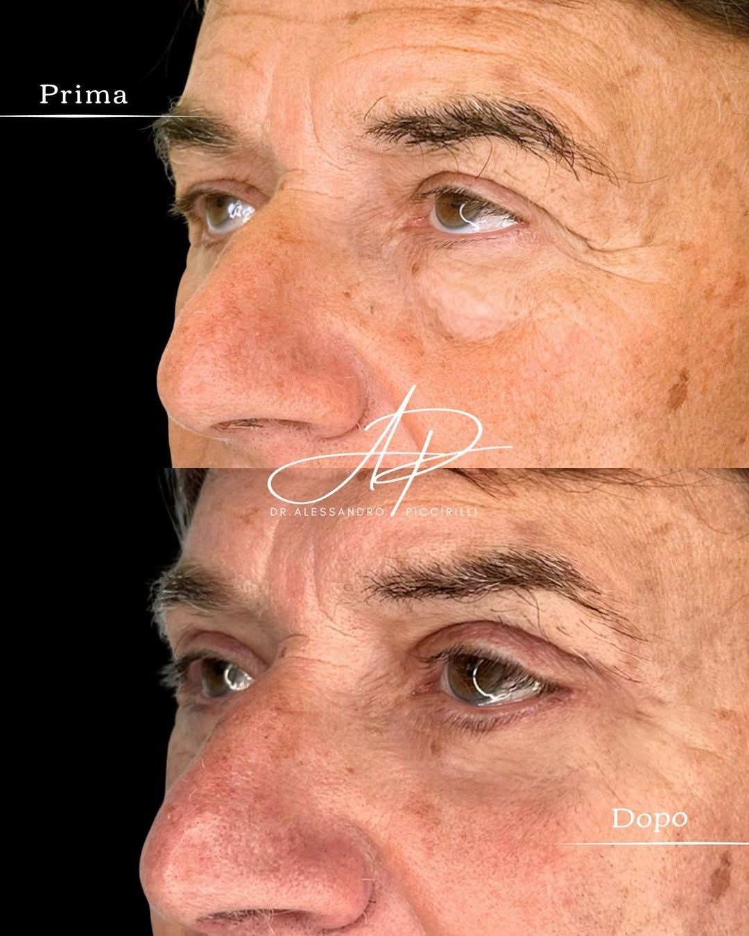 Sguardo rigenerato e naturalezza dei tessuti